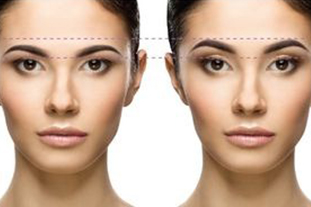 How Can a Brow Lift Improve Your Face?