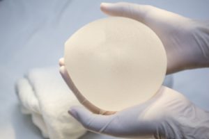 Implant Rupture
