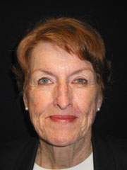 Before Browlift, Blepharoplasty, Rhinoplasty, Face and Neck lift, Fat Augmentation, Laser Resurfacing