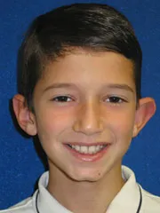 before Ear Surgery