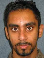 After Rhinoplasty