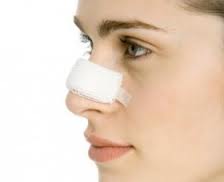 Nose Job Surgery Cast