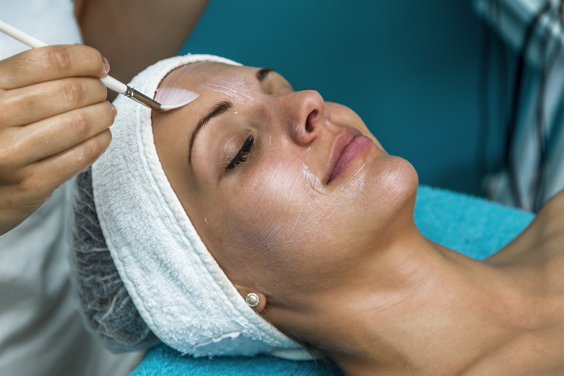 Unlock Your Best Skin: The Essential Guide to Chemical Peels