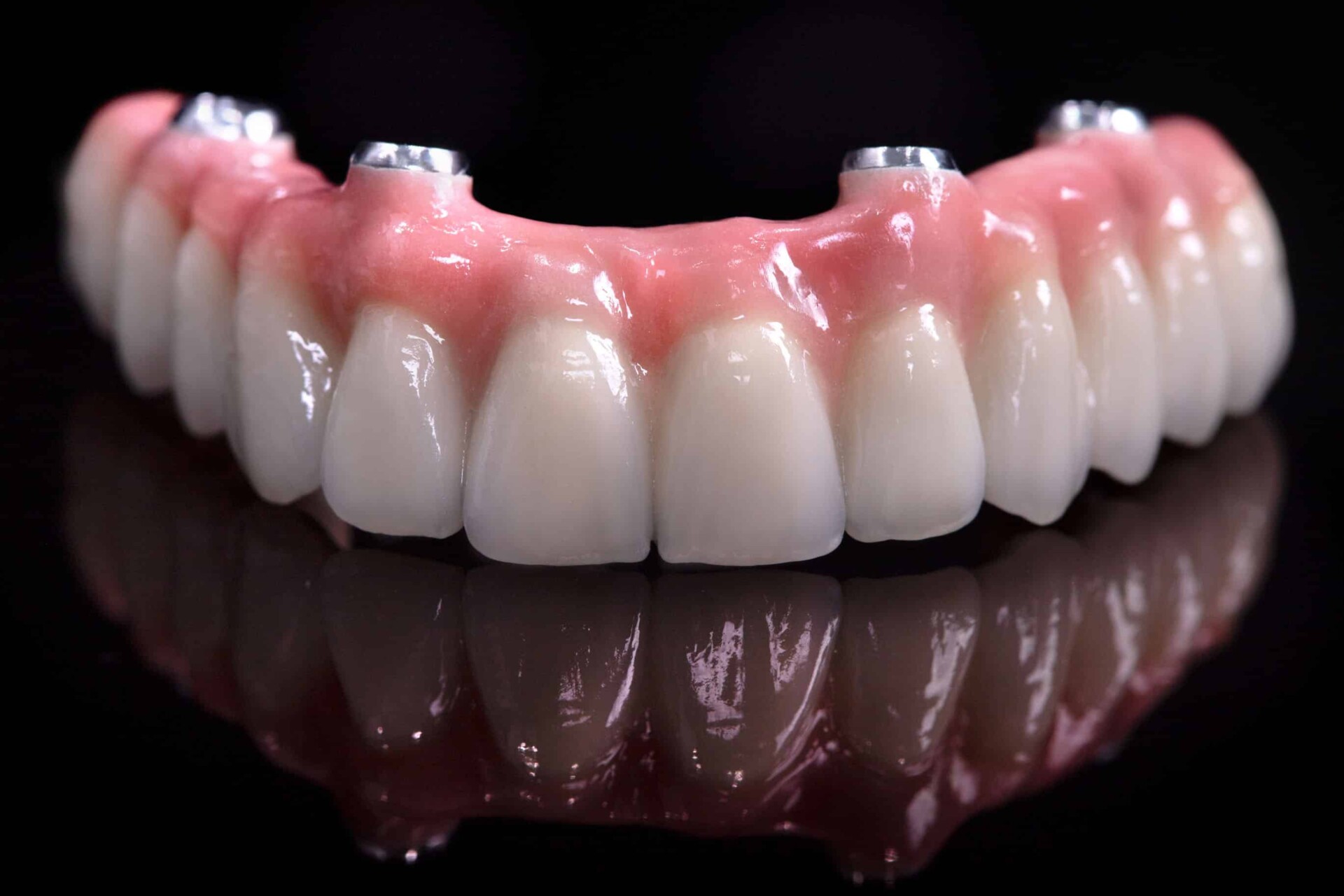 What Are All-on-Four Dental Implants? 